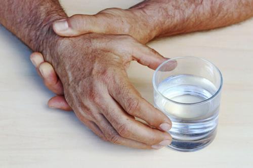 خطر ابتلای شدید به كووید-۱۹ در بیماران مبتلا به پاركینسون