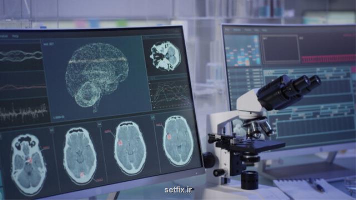 ضبط یك سیگنال مغزی با فناوری كوانتومی برای اولین بار