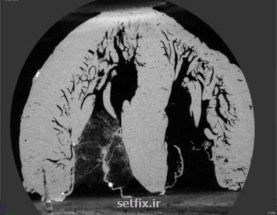 تلاش پژوهشگران آمریکایی برای ابداع مدل کامپیوتری ساختارهای داخلی قلب انسان