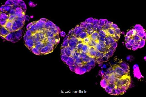 انفجار کپسول حاوی داروی شیمی درمانی در تومور با کمک امواج فراصوت