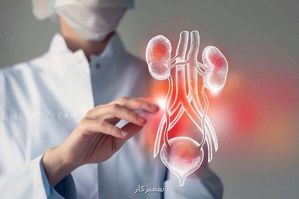 تصویربرداری دقیق تر از تومور سرطانی مثانه با نانوفناوری