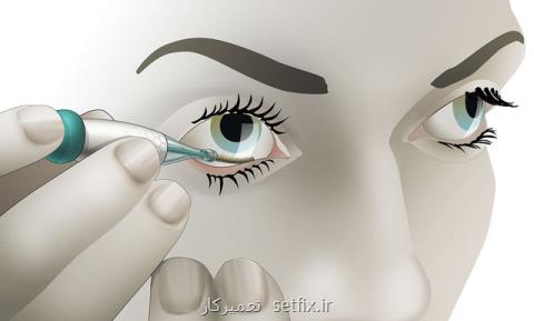 ابداع سنسور چشمی اندازه گیری گلوكز توسط استارتاپ هلندی