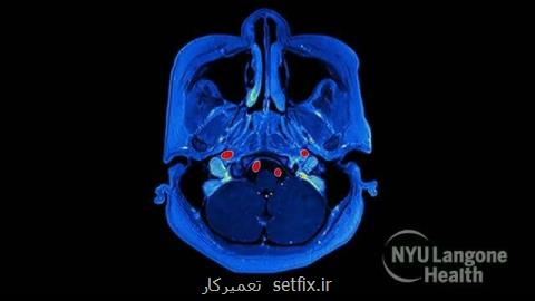 شناسایی افراد مبتلا به لطمه روانی با تحلیل صدای آنها