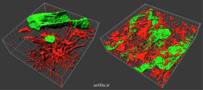 درمان دقیق تر تومورهای مغزی با كمك تجزیه و تحلیل سه بعدی